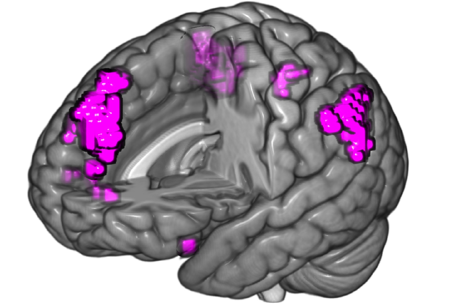 deja vu study fmri conflict dejavu