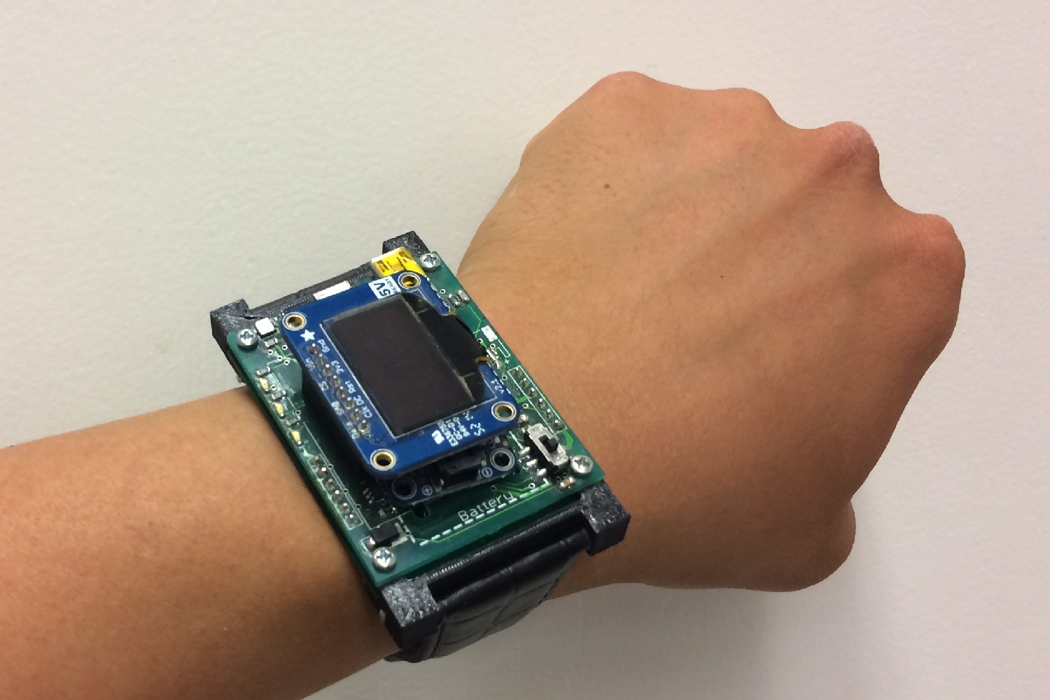 emosquito wearable diabetes prototype on forearm 1